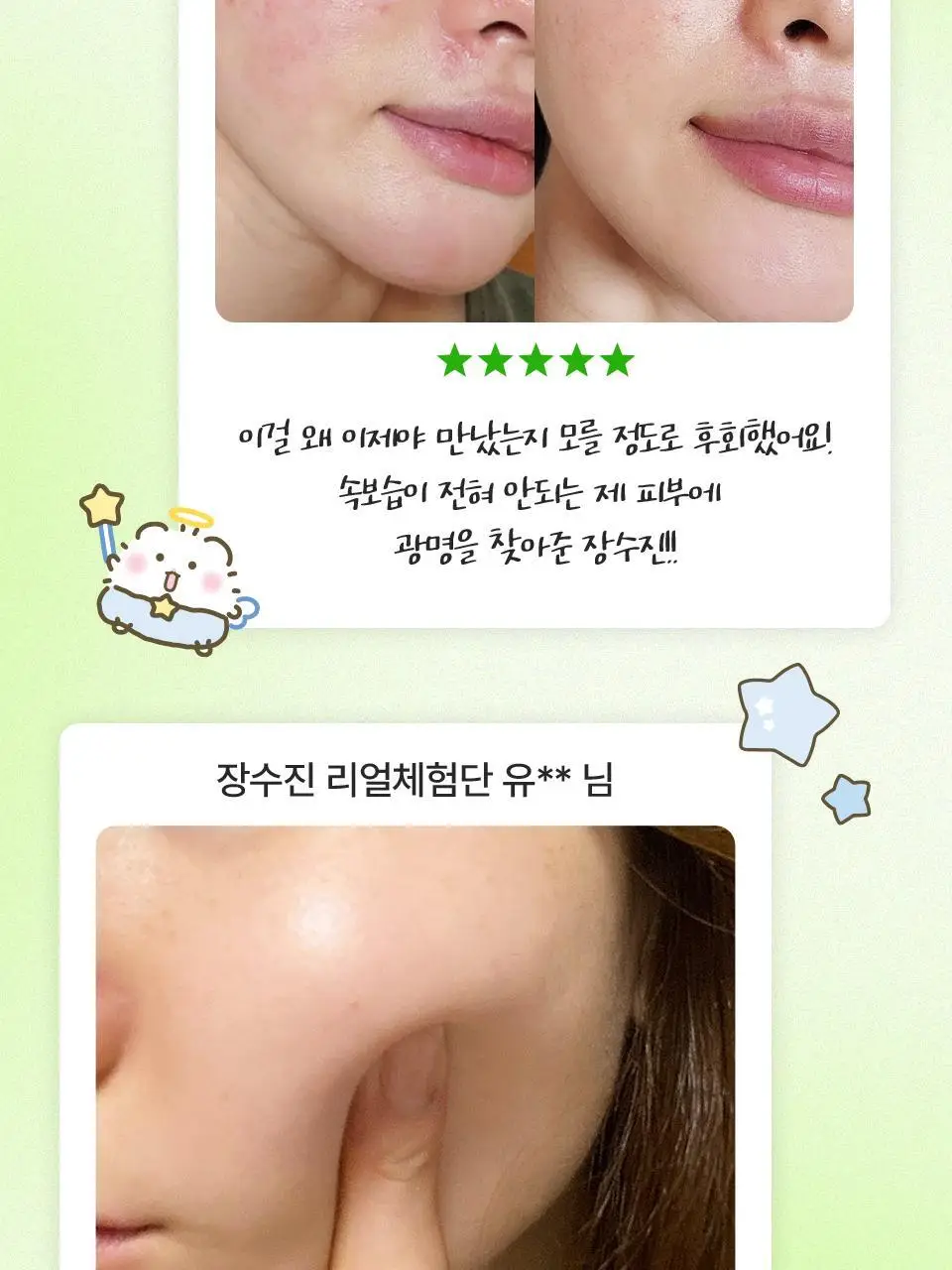 [망곰 콜라보] 아이소이 모이스춰 닥터 장수진 수분크림 100ml 대용량 기획 (+10ml+맥세이프 카드지갑) 상세페이지 12